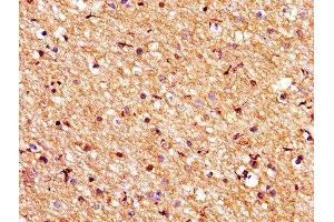IHC image of ABIN7175545 diluted at 1:200 and staining in paraffin-embedded human brain tissue performed on a Leica BondTM system. (PROS1 antibody  (AA 42-676))