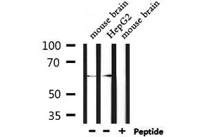 Western blot analysis of extracts from mouse brain and HepG2, using STIP1  Antibody. (STIP1 antibody  (N-Term))