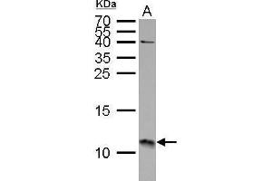 WB Image S100A11 antibody detects S100A11 protein by Western blot analysis. (S100A11 antibody)