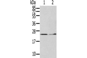 Gel: 12 % SDS-PAGE,Lysate: 40 μg,Lane 1-2: Hela cells, Human fetal liver tissue,Primary antibody: ABIN7127970(ITPA Antibody) at dilution 1/400 dilution,Secondary antibody: Goat anti rabbit IgG at 1/8000 dilution,Exposure time: 5 minutes (ITPA antibody)