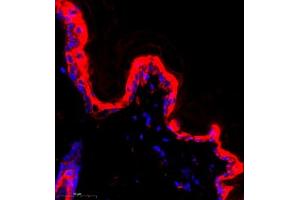 Immunofluorescence of paraffin embedded rat skin using CK13 (ABIN7074411) at dilution of 1:500 (400x lens)