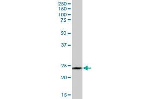 GOSR2 MaxPab polyclonal antibody. (GOSR2 antibody  (AA 1-213))