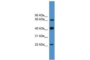 WB Suggested Anti-TCEAL6 Antibody Titration:  0. (TCEAL6 antibody  (C-Term))