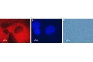 Expression of CLIC4 in human pancreatic carcinoma PANC-1 cells - Immunocytochemical staining of fixed and permeabilized human pancreatic carcinoma PANC-1 cells. (CLIC4 antibody  (Intracellular))