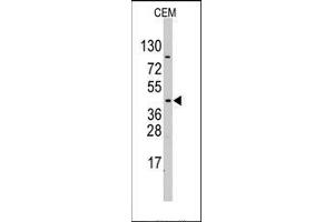 Western blot analysis of PDK4 Antibody in CEM cell line lysates (35ug/lane). (PDK4 antibody  (Middle Region))