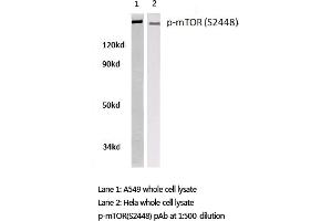Western blot (WB) analysis of p-mTOR antibody in extracts from A549 and Hela cells. (MTOR antibody  (pSer2448))