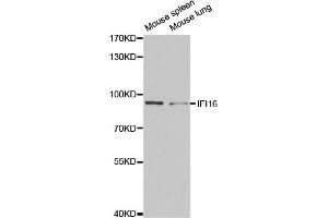Western blot analysis of extracts of various cell lines, using IFI16 antibody (ABIN5971048) at 1/1000 dilution. (IFI16 antibody)