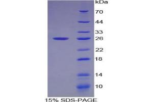 SDS-PAGE analysis of Cow Smad1 Protein.