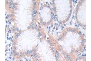 Detection of CTNNa1 in Human Stomach Tissue using Polyclonal Antibody to Catenin Alpha 1 (CTNNa1) (CTNNA1 antibody  (AA 2-228))