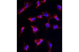 Immunofluorescence analysis of anti-NANOS1 Antibody (C-term) in HeLa cells.