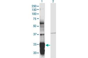 Western Blotting (WB) image for anti-serpin Peptidase Inhibitor, Clade B (Ovalbumin), Member 5 (SERPINB5) (AA 1-231) antibody (ABIN2565883)