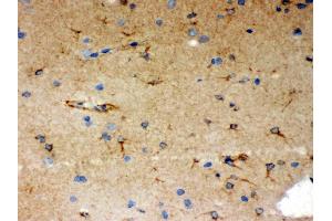 Immunohistochemistry (IHC) image for anti-SHC (Src Homology 2 Domain Containing) Transforming Protein 1 (SHC1) (AA 536-564), (C-Term) antibody (ABIN3043923)