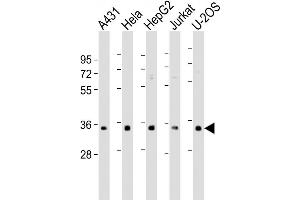 Western Blot at 1:500-1:1000 dilution Lane 1: A431 whole cell lysate Lane 2: Hela whole cell lysate Lane 3: HepG2 whole cell lysate Lane 4: Jurkat whole cell lysate Lane 5: U-2OS whole cell lysate Lysates/proteins at 20 ug per lane.