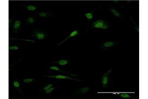 Immunofluorescence of monoclonal antibody to PRDM1 on HeLa cell. (PRDM1 antibody  (AA 422-493))