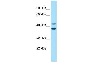 Western Blotting (WB) image for anti-Gliomedin (GLDN) (N-Term) antibody (ABIN2790542) (GLDN antibody  (N-Term))