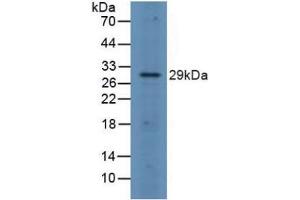 Detection of FOSL1 in Rat Spleen Tissue using Polyclonal Antibody to FOS Like Antigen 1 (FOSL1) (FOSL1 antibody  (AA 1-271))