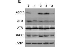 Generation of Asciz-deficient mice. (ATM antibody  (pSer1981))
