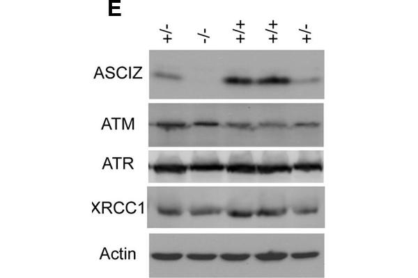 ATM antibody  (pSer1981)