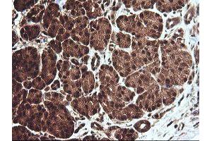 Image no. 3 for anti-Chaperonin Containing TCP1, Subunit 8 (Theta)-Like 2 (CCT8L2) antibody (ABIN1497479) (CCT8L2 antibody)