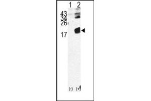 Image no. 1 for anti-beta-2-Microglobulin (B2M) (N-Term) antibody (ABIN357931) (beta-2 Microglobulin antibody  (N-Term))