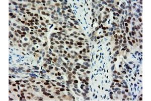 Immunohistochemical staining of paraffin-embedded Human Kidney tissue using anti-NT5DC1 mouse monoclonal antibody.
