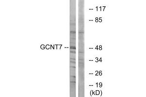 Western Blotting (WB) image for anti-Glucosaminyl (N-Acetyl) Transferase Family Member 7 (GCNT7) (C-Term) antibody (ABIN1850894) (GCNT7 antibody  (C-Term))