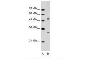 Image no. 1 for anti-Interferon Regulatory Factor 6 (IRF6) (AA 351-400) antibody (ABIN203471)