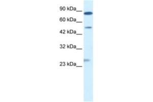 Western Blotting (WB) image for anti-Chloride Channel, Voltage-Sensitive 6 (CLCN6) antibody (ABIN2461139) (CLCN6 antibody)