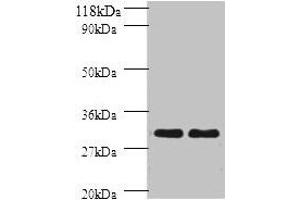 Western blot All lanes: HLA-DPB1 antibody at 2 μg/mL Lane 1: sw1990 whole cell lysate Lane 2: HGC27 whole cell lysate Secondary Goat polyclonal to rabbit IgG at 1/10000 dilution Predicted band size: 30 kDa Observed band size: 30 kDa (HLA-DPB1 antibody  (AA 30-225))