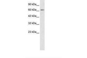 Image no. 1 for anti-Zinc Finger Protein 649 (ZNF649) (AA 436-485) antibody (ABIN202680)