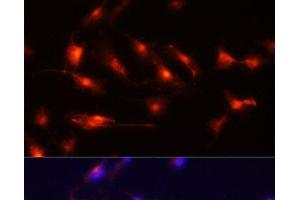 Immunofluorescence analysis of U-251MG cells using Nestin Polyclonal Antibody at dilution of 1:100 (20x lens). (Nestin antibody)
