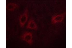 ABIN6267562 staining HepG2 cells by ICC/IF. (Calmodulin 1 antibody  (pSer81, pThr79))