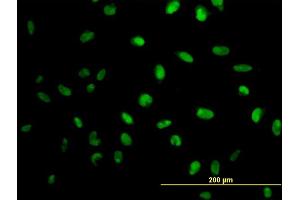 Immunofluorescence of monoclonal antibody to MPG on HeLa cell. (MPG antibody  (AA 1-90))