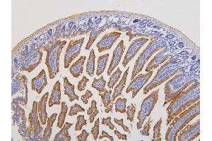IHC analysis of RAB3GAP2 using anti-RAB3GAP2 antibody (ABIN6719633).