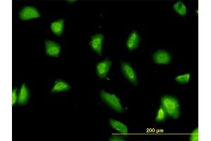 Immunofluorescence of monoclonal antibody to G3BP on HeLa cell.