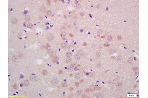 Formalin-fixed and paraffin embedded rat brain labeled with Anti-Parkin protein/PARK2 Polyclonal Antibody, Unconjugated (ABIN735578) at 1:200 followed by conjugation to the secondary antibody and DAB staining. (Parkin antibody  (AA 361-465))