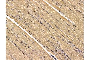 ABIN7095950 and ABIN7100012 at 1/100 staining rat muscle tissue by IHC-P. (SCYL3 antibody)