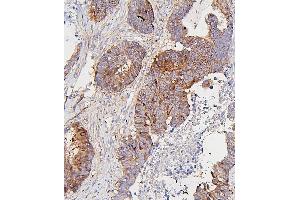 IHC analysis of CDK1 using anti-CDK1 antibody (ABIN7602240). (CDK1 antibody  (AA 66-297))