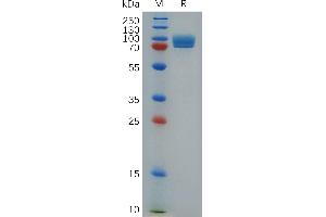 Stabilin 1 (STAB1) (AA 638-1024) protein (Fc Tag)