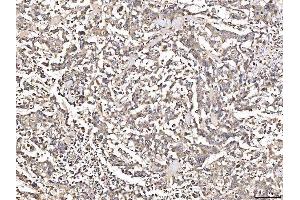 IHC analysis of Angiotensinogen/AGT using anti-Angiotensinogen/AGT antibody (ABIN7601392).