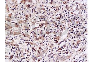 Immunohistochemistry (IHC) image for anti-Placenta Growth Factor (PGF) (AA 166-221) antibody (ABIN727235)