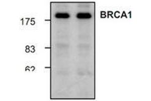 Image no. 1 for anti-Breast Cancer 1 (BRCA1) antibody (ABIN155101) (BRCA1 antibody)