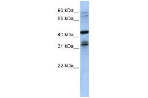 MSI2 antibody used at 1 ug/ml to detect target protein.