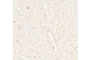 Immunohistochemistry (IHC) image for anti-Energy Homeostasis Associated (ENHO) (C-Term) antibody (ABIN2457882) (ENHO antibody  (C-Term))