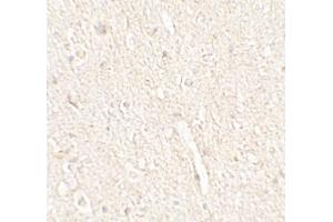 Immunohistochemistry (IHC) image for anti-Energy Homeostasis Associated (ENHO) (C-Term) antibody (ABIN2457882) (ENHO antibody  (C-Term))