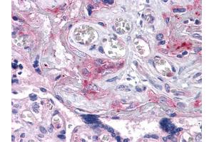 Immunohistochemical analysis of paraffin-embedded human Placenta tissues using ERN1 mouse mAb (ERN1 antibody)