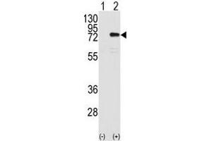 Western Blotting (WB) image for anti-Protein Kinase C, eta (PRKCH) antibody (ABIN3002933) (PKC eta antibody)