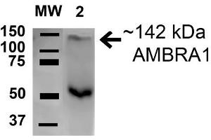Western blot analysis of Rat Brain cell lysates showing detection of 142. (AMBRA1 antibody  (AA 200-300) (Biotin))