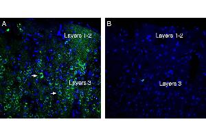 Expression of Neogenin in rat parietal cortex.