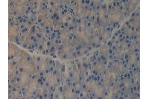 Immunohistochemistry (IHC) image for anti-Regenerating Islet-Derived 3 beta (REG3B) (AA 27-175) antibody (ABIN7441622)